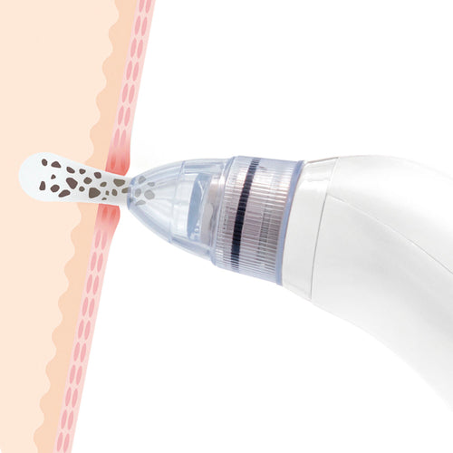 InnovaGoods Electric Facial Sauna & Blackhead Remover Set